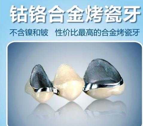 炫彩烤瓷牙怎么样？大概多少钱？炫彩烤瓷牙补牙前后对比！