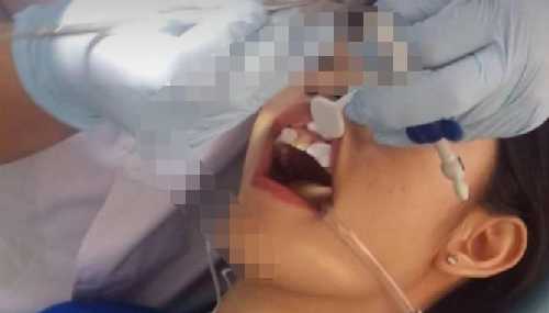 海涛口腔医院补牙多少钱？影响价格的因素有哪些？真人补牙体验反馈！