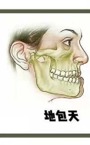 地包天怎么治疗？内含价格表以及优秀案例