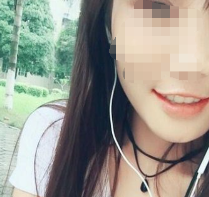 广州好大夫口腔门诊部邓宏亮牙齿矫正案例
