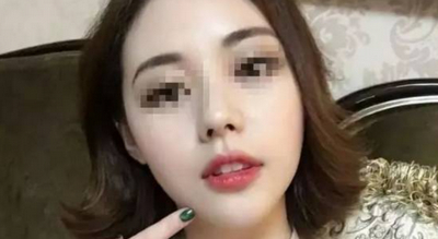 长沙市口腔医院段亚光做牙齿矫正手术案例分享