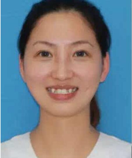 北京协和医院口腔科万阔牙齿矫正真人案例分享