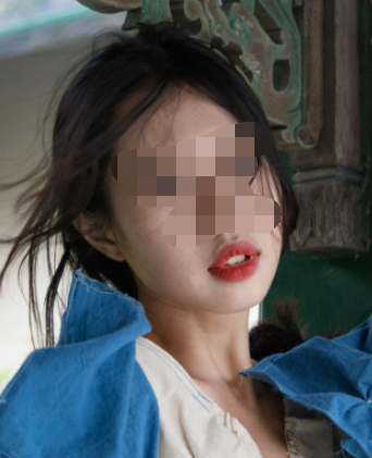 广州华美口腔李敏华牙齿美白真人案例展示