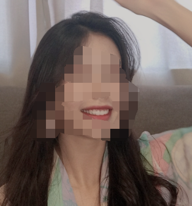 广州华美口腔李敏华牙齿美白真人案例展示