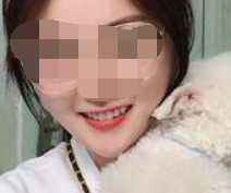 广州华美口腔杨金志牙齿贴面案例分享
