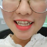 平海路口腔医院怎么样？附案例分析和价格表