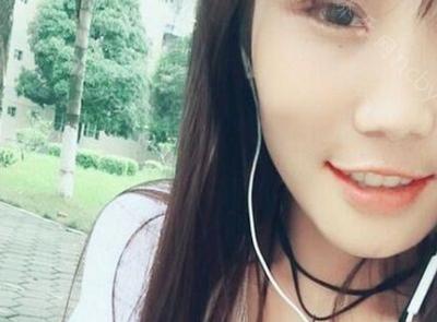 杭州瑞创口腔门诊卢来臣做牙齿矫正的案例分享