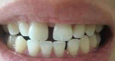 厦门登特口腔医院怎么样？内附案例
