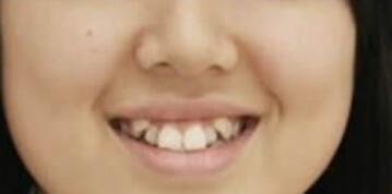 吴云才口腔诊所怎么样？内附案例