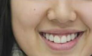 吴云才口腔诊所怎么样？内附案例