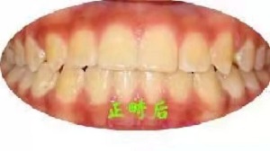 为什么地包天的人越来越多？内含价格表及案例分析