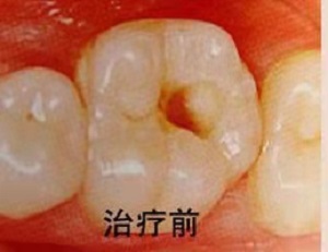 登特口腔医院正规吗？内含价格表及案例分析