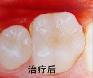 登特口腔医院正规吗？内含价格表及案例分析