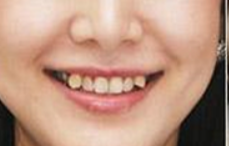 洛阳友好口腔怎么样？内附案例及价格表