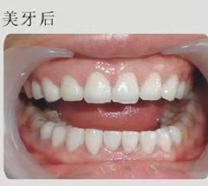 南宁天使口腔医院怎么样？内含价格表及案例分析