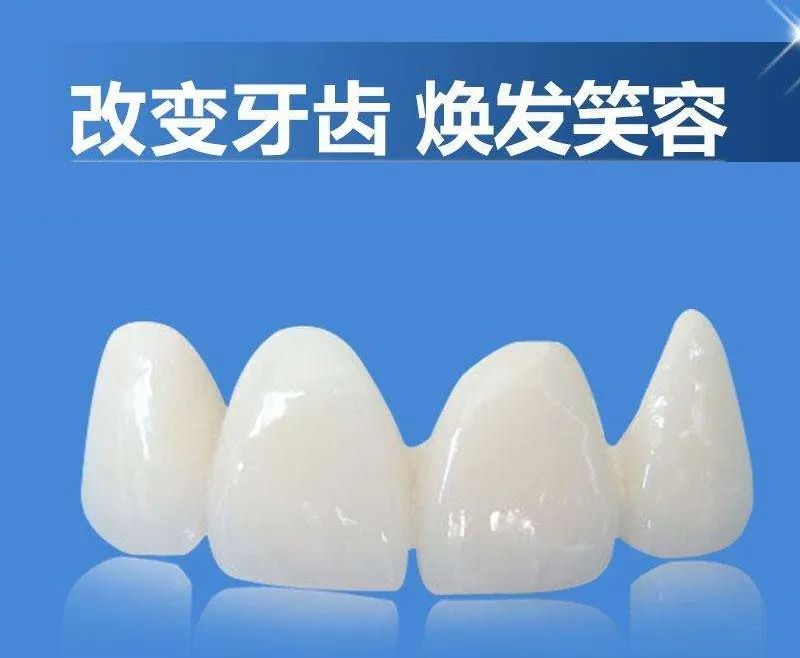 威兰德全瓷牙好不好？附案例分析和价格表