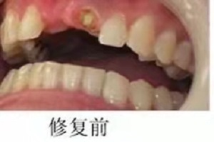 浙江省口腔医院城西分院怎么样？内含价格表及案例分析