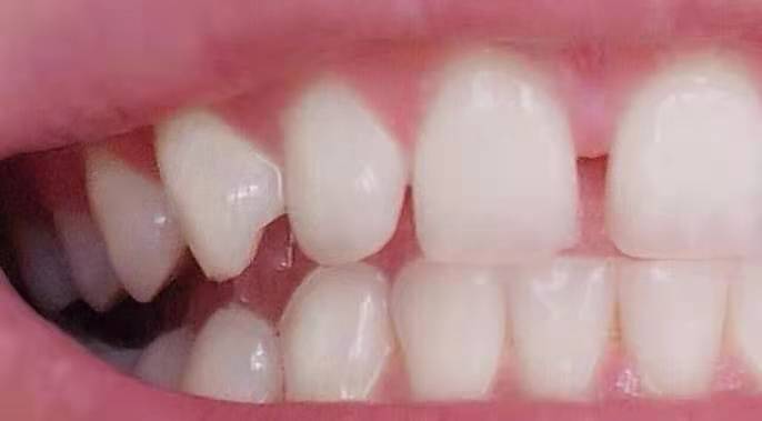 慈溪华阳口腔医院咋样？价格贵不贵，术后效果好不？
