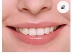 珠海市口腔医院怎么样？内含价格表及案例分析