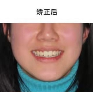 诸城口腔医院怎么样？内含价格表及案例分析