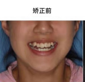诸城口腔医院怎么样？内含价格表及案例分析