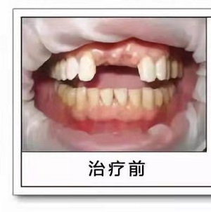 杭州平海路口腔医院怎么样？内含价格表及案例分析