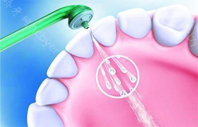 爱康齿科健之维分院种植牙价格表公布：价格优势体现在哪里？