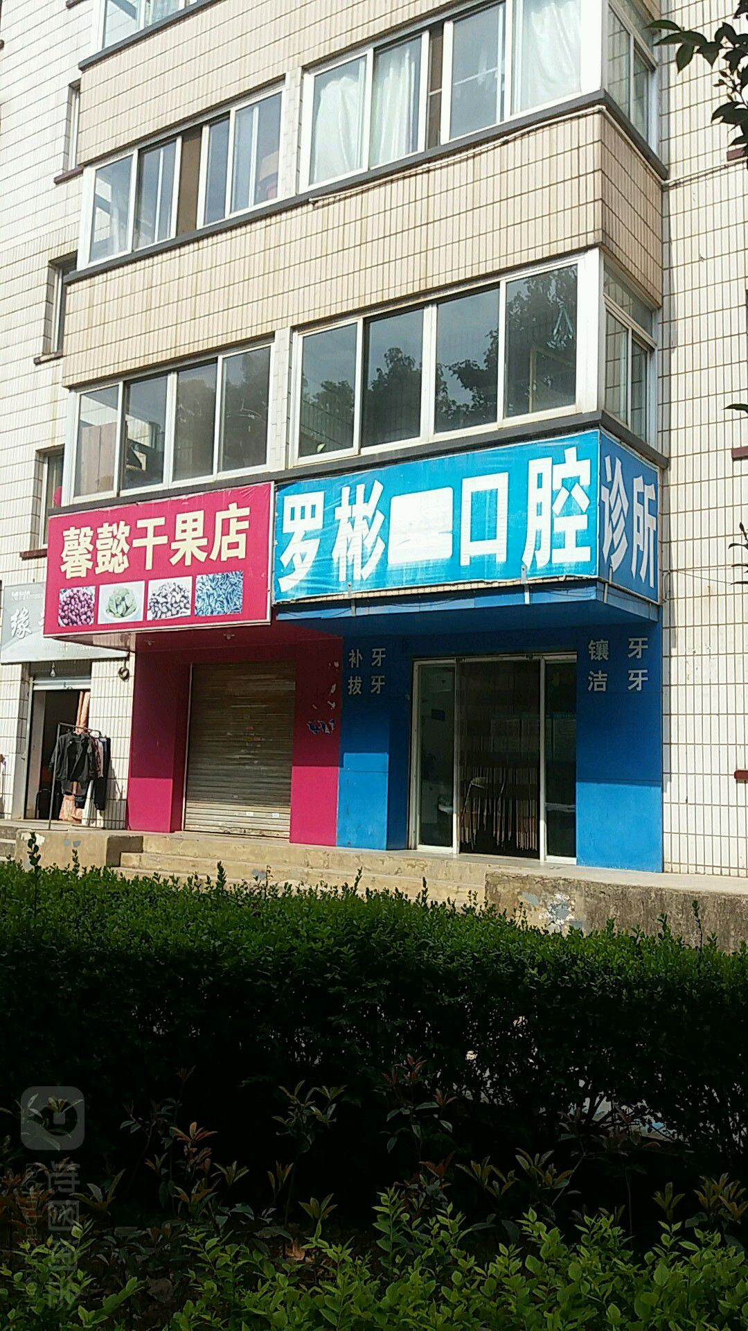 昆明补牙优惠价格均价公布(2024昆明补牙参考价为：15935元)
