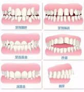 矫正牙齿拍片多少钱_什