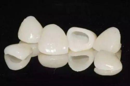 钦州全瓷牙种植2024价格表:以色列dentin(丹因)种植牙价格:2000元起/瑞士拓美种植牙:2800元起