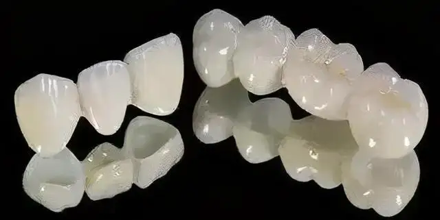 为什么医生不愿意拆烤瓷牙烤瓷牙有哪些情况需要赶紧拆除。