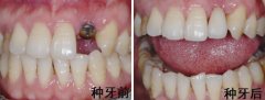 迈维齿科是正规医院吗？