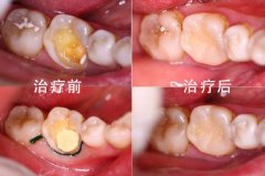 广州阳光树口腔是正规医