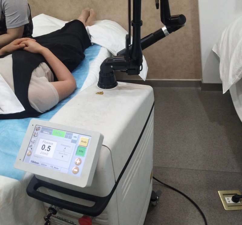 合肥眼部整形收费价格表，眼皮下垂矫正：1164\眼角修复手术：1568起
