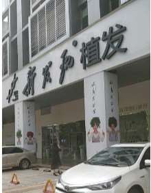 广州暨南大学附属第一医院植发养发收费价目表，头发种植：401\其他部位：389起