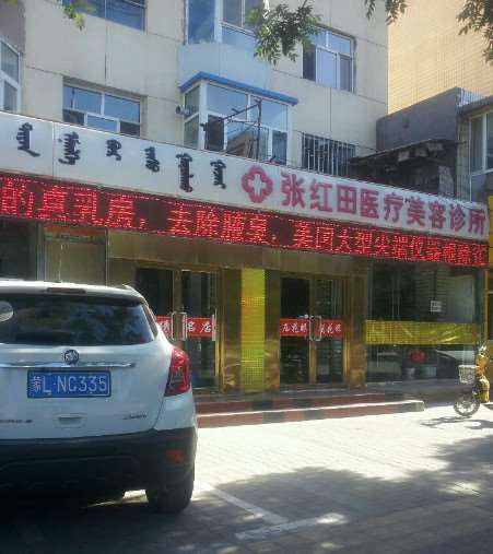 巴彦淖尔艾氏联合眼部整形收费价目表，眼修复：2828\眼袋失败修复：3373起