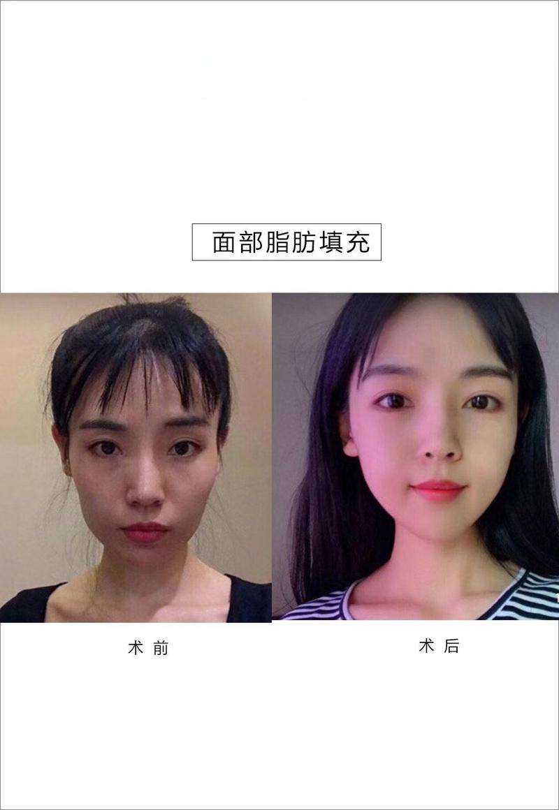 大理韩美医疗美容眼部整形收费价目表，消除肿眼泡失败修复：189\下睑整形：1394起