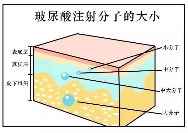 重庆南城口腔玻尿酸丰卧蚕价格2026明细!眼部美容专业医生坐诊
