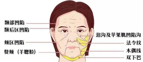 石家庄雅芳亚医疗美容医院怎么样?点击了解抗衰除皱的专业实力
