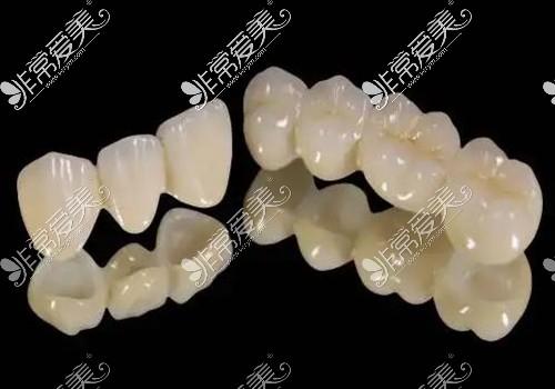 2025重庆南城口腔医院价目表，含种植牙-矫正价格表