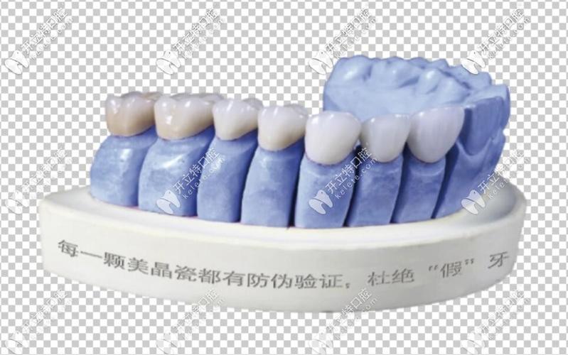 爱迪特全瓷牙冠多少钱一颗？2+质量不输爱尔创-可以用后牙冠