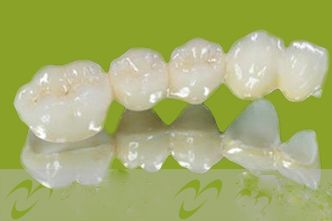 全瓷牙和烤瓷牙哪个好区别在哪？全瓷牙通透美观、烤瓷牙便宜
