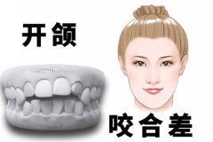 赣州牙齿种植价格表：赣