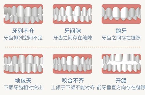 为什么医生不建议牙齿打