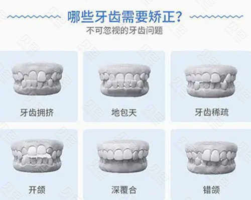 上海臻吻口腔做牙齿矫正贵不贵？非常新收费清单公开，隐形矫正仅9800元起