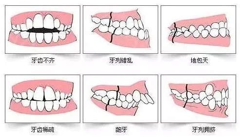 牡丹江张月鹏口腔地址+电话号码+交通路线+收费价格表一览，可在线预约