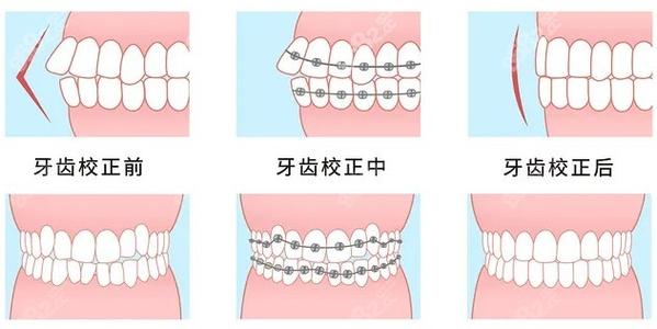 兰州一柚口腔医院常国鹏