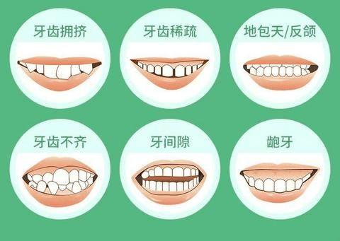 文昌哪个牙科比较好还便宜？网友票选top5+文昌牙科收费价格
