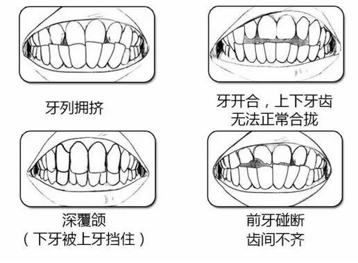 北京启康口腔朝阳区牙齿矫正,时代天使隐形矫正18000元起