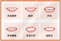 青岛菲尔齿科牙齿矫正收